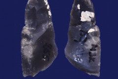 152-238
