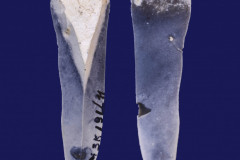 191-11