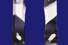 201-11